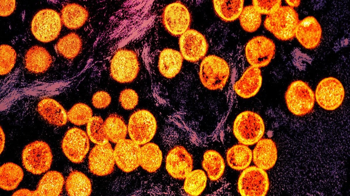 Monkeypox (mpox) : un nouveau cas autochtone au Royaume-Unis, découvrez les symptômes et les modes de transmission du virus 2 Particules de mpox, le virus du monkeypox qui a déclenché la nouvelle urgence sanitaire mondiale avec le nouveau clade 1b / Photo Credit NIAID