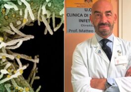 Pourquoi cette année la grippe sera-t-elle plus virulente ? Bassetti alerte : "Le virus peut attaquer le cerveau" 19 FACEBOOK | A destra una foto del Prof. Matteo Bassetti dal uso account Facebook