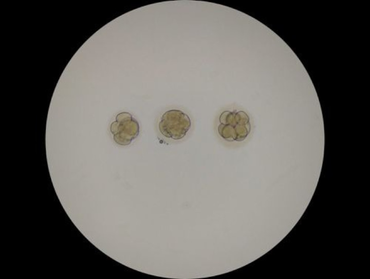 Naît le premier bébé conçu grâce à une technologie de fertilité révolutionnaire 4 1734635375 689 Nait le premier bebe concu grace a une technologie de