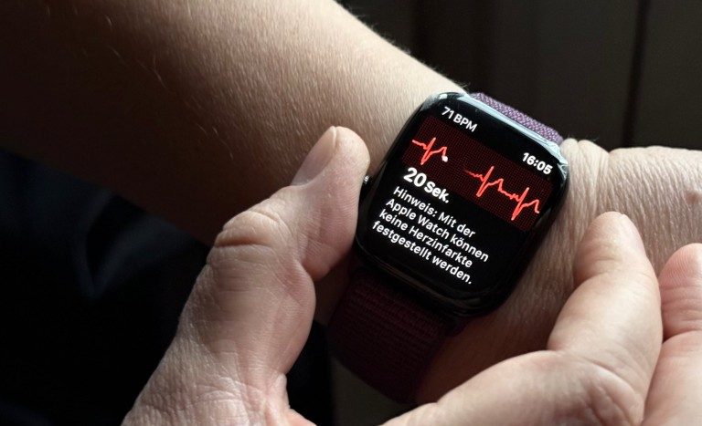 Que signifient vraiment la fréquence cardiaque, la SpO2 et autres ? 9 Enregistrement de l'ECG