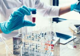 Analyse sanguine et cancer du sein : découvrez comment le nouveau test détecte la maladie avant la biopsie liquide 21 Un nuovo esame del sangue che combina l'analisi laser con un tipo di intelligenza artificiale è il primo del suo genere a identificare il tumore al seno nelle fasi iniziali / Photo iStock
