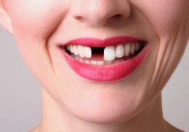 Découvrez comment ce médicament révolutionnaire fait repousser les dents : les tests sur l'homme ont commencé 14 Image