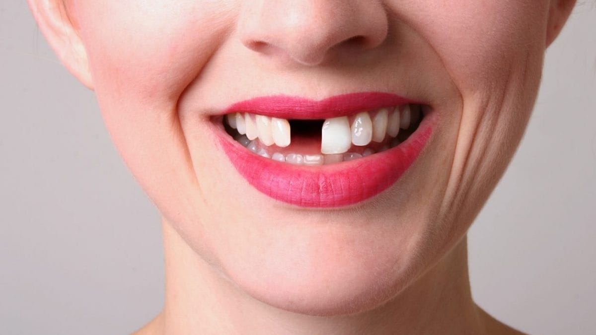 Découvrez comment ce médicament révolutionnaire fait repousser les dents : les tests sur l'homme ont commencé 2 Image