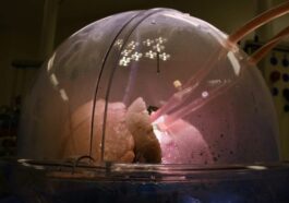 Double transplantation pulmonaire chez un ancien fumeur avec une machine salvatrice surnommée « Poumons en boîte » 1 La plateforme de perfusion pulmonaire ex vivo XPS. Crédit: Royal Papworth Hospital / XVIVO