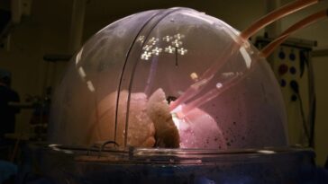 Double transplantation pulmonaire chez un ancien fumeur avec une machine salvatrice surnommée « Poumons en boîte » 24 La plateforme de perfusion pulmonaire ex vivo XPS. Crédit: Royal Papworth Hospital / XVIVO
