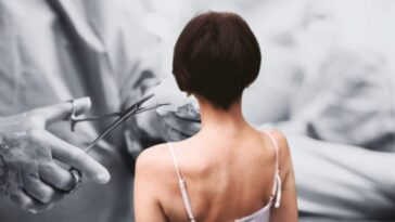 L'affaire Essure : la dénonciation de 18 femmes : "C'était juste un contraceptif, puis nous avons dû retirer notre utérus" 12 L'affaire Essure : la dénonciation de 18 femmes : "C'était juste un contraceptif, puis nous avons dû retirer notre utérus"