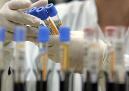 Une seule mutation dans l'hémagglutinine du virus de l'influenza aviaire peut rendre le pathogène transmissible d'homme à homme / Photo Getty