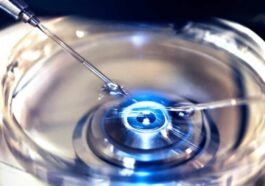 Fécondation in Vitro