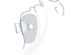 Le système Genio est composé d'un stimulateur et d'une puce d'activation qui se fixe avec un patch sous le menton / Crédit Nyxoah
