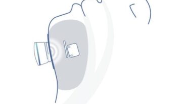 Le système Genio est composé d'un stimulateur et d'une puce d'activation qui se fixe avec un patch sous le menton / Crédit Nyxoah