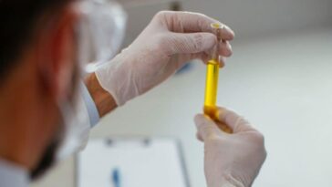 Un nouveau examen urinaire pourrait détecter les premiers signes de cancer du poumon des années avant les symptômes / Photo iStock