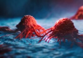 Un tissu sain peut ressembler à une tumeur maligne : une découverte troublante dans les cellules de femmes sans cancer 152 Image
