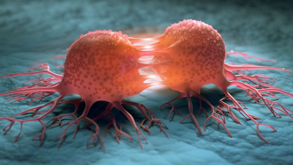 I ceppi di Escherichia coli produttori di colibactina possono essere responsabili dello sviluppo di cancro del colon retto e del tratto urinario