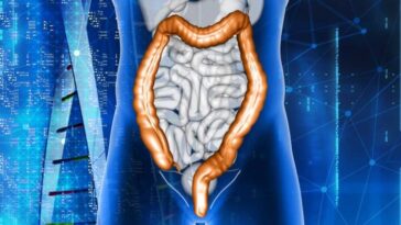 Une étude relie l'augmentation des cancers de l'intestin à ces habitudes alimentaires ! 2 Santé de l'intestin
