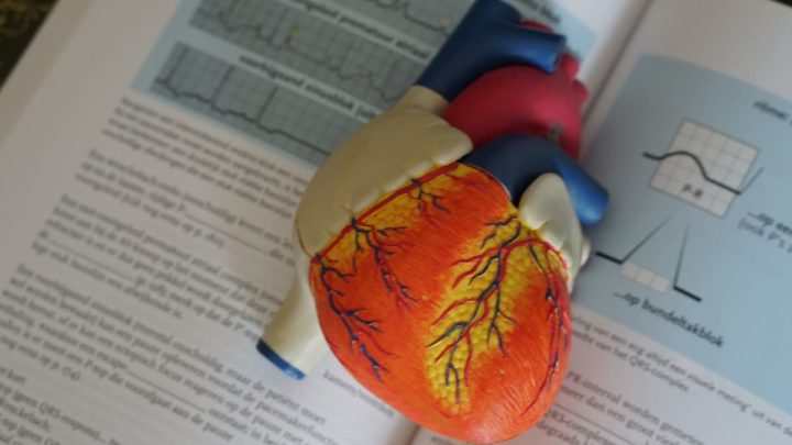 Des scientifiques utilisent des TAC et de l'IA pour anticiper les crises cardiaques des années à l'avance 1 Des scientifiques utilisent des TAC et de l'IA pour anticiper les crises cardiaques des années à l'avance