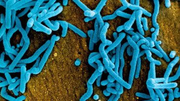 Épidémie de virus Marburg en Tanzanie : jusqu'à 9 personnes contaminées sur 10 décèdent, découvrez les symptômes et les modes de transmission 8 Virus Marburg. Crédit : NIAID
