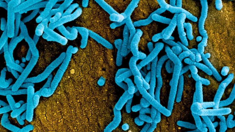 Épidémie de virus Marburg en Tanzanie : jusqu'à 9 personnes contaminées sur 10 décèdent, découvrez les symptômes et les modes de transmission 1 Virus Marburg. Crédit : NIAID