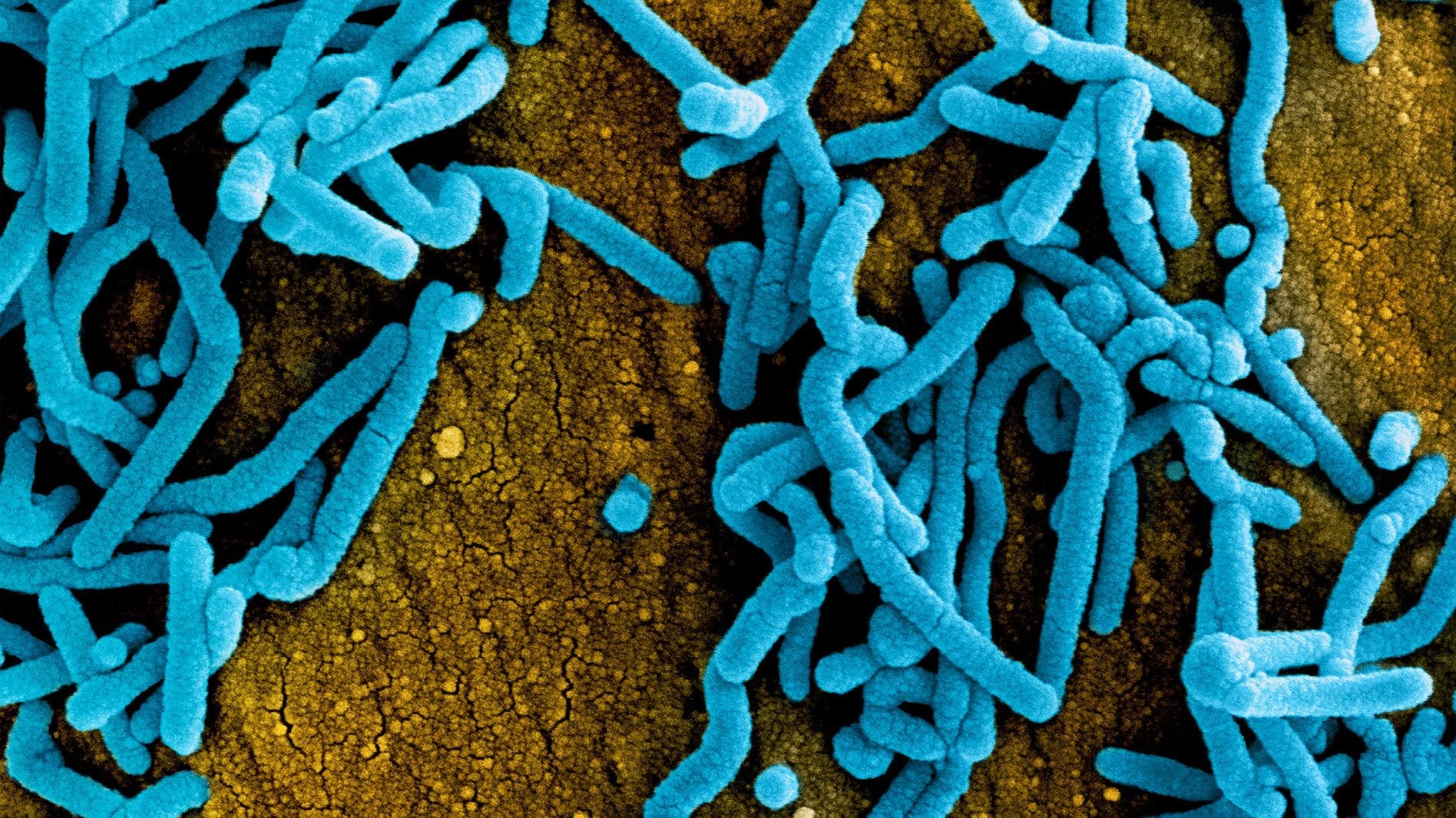 Épidémie de virus Marburg en Tanzanie : jusqu'à 9 personnes contaminées sur 10 décèdent, découvrez les symptômes et les modes de transmission 2 Virus Marburg. Crédit : NIAID