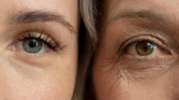 Les premiers signes d'un AVC se voient dans les yeux : quels sont-ils et que peuvent-ils révéler 4 Immagine