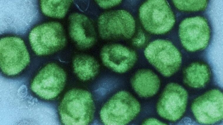 Premier cas de la nouvelle variante du monkeypox en France : ce que nous savons 1 Immagine