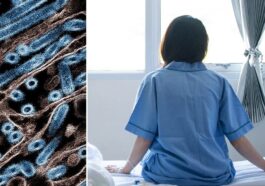 La ragazza canadese di 13 anni sopravvissuta a una forma grave di influenza aviaria ha manifestato inizialmente sintomi simil-influenzali, come febbre, tosse e congiuntivite, ma il suo quadro clinico è stato complicato da insufficienza respiratoria, polmonite e insufficienza renale / Photo Credit NIAID/iStock