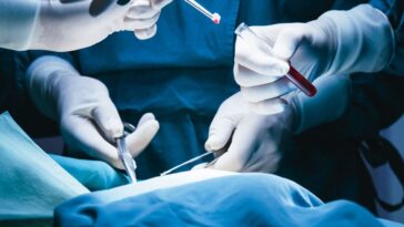 Un chirurgien contracte le cancer d'un patient qu'il opérait : un cas unique en son genre 24 Un chirurgien a développé un nodule cancéreux à la main après s'être blessé lors d'une opération d'extraction de cette même tumeur / Photo iStock