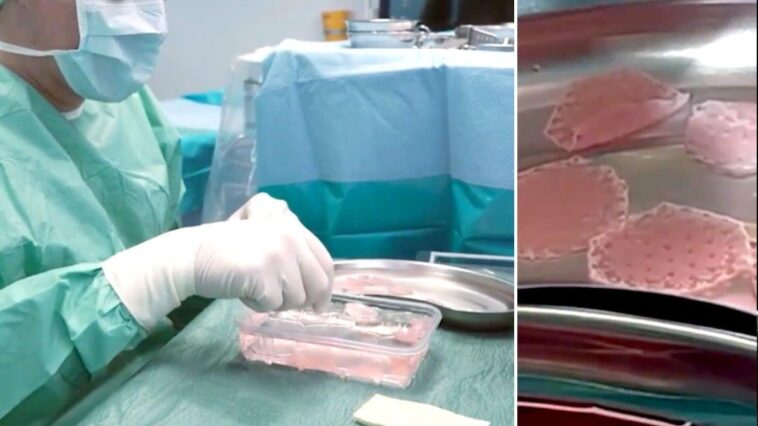 Un patch révolutionnaire régénère le tissu cardiaque d'une patiente, découverte saisissante dans Nature 1 Le patch pour régénérer les tissus du cœur montré par le professeur Wolfram-Hubertus Zimmermann, directeur du Département de pharmacologie et de toxicologie du Centre médical universitaire de Gottiga, en Allemagne