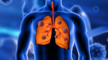 Le cancer du poumon augmente chez les non-fumeurs et une raison potentielle émerge 11 Le cancer du poumon augmente chez les non-fumeurs et une raison potentielle émerge
