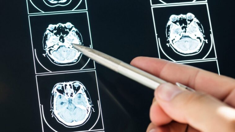 Bien dormir protège la mémoire contre Alzheimer : l'impact du sommeil profond 1 Image