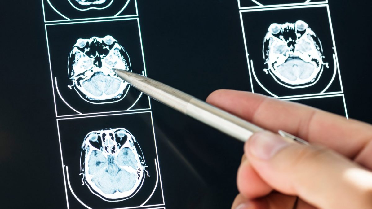 Bien dormir protège la mémoire contre Alzheimer : l'impact du sommeil profond 2 Image