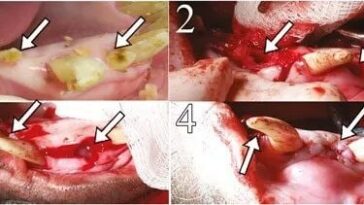 Des dents humaines cultivées dans des porcs : la découverte qui pourrait rendre les implants dentaires obsolètes 25 Images des dents humaines cultivées dans la bouche d'un des porcs : 1) Avant l'extraction et 2) Immédiatement après l'extraction de la dent. 3) Positionnement de l'implant et 4) Alvéole dentaire suturée / Crédit : Stem Cells Translational Medicine 2024