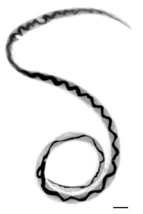 Elle pensait avoir un décalage horaire, mais elle avait des larves de parasite dans le cerveau : cas clinique d'une femme 2 Angiostrongylus cantonensis. Credit: Wikipedia