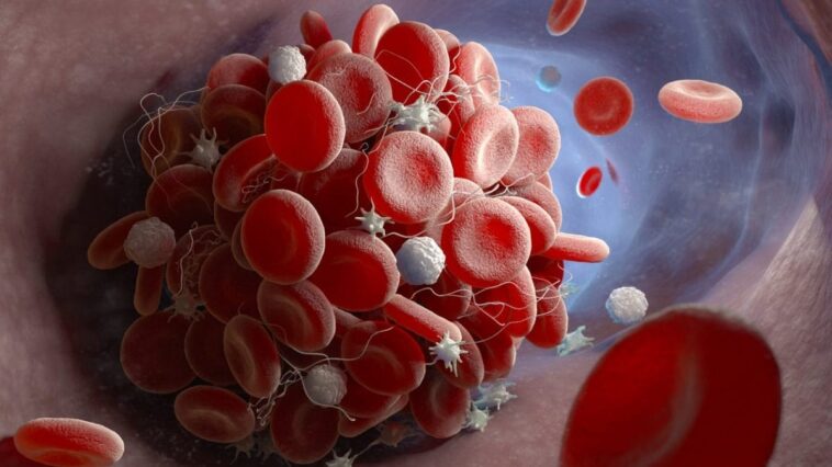 Les premiers signes de thrombose décelés par un nouveau test : "Ils prédisent infarctus et AVC avec 10 ans d'avance" 1 Immagine
