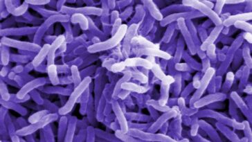 Qu'est-ce que le choléra, comment se transmet-il et quels sont les symptômes de l'infection causée par la bactérie Vibrio cholerae ? 1 Image au microscope électronique à balayage de Vibrio cholerae, la bactérie qui cause le choléra / Crédit : Wikipedia