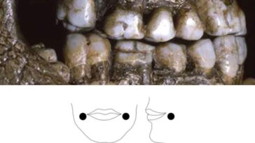 Résolu : le mystère des étranges marques sur les dents des enfants de l'ère glaciale dévoilé ! 2 I segni di usura osservati sui denti suggeriscono l’uso di piercing alle guance già dall’infanzia / Credit John Willman