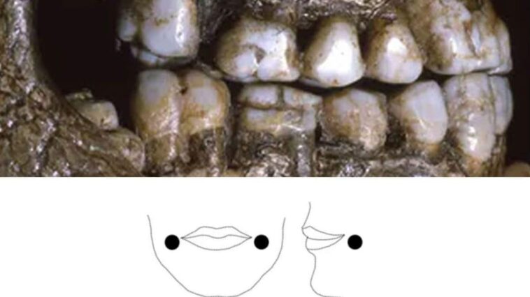 Résolu : le mystère des étranges marques sur les dents des enfants de l'ère glaciale dévoilé ! 1 I segni di usura osservati sui denti suggeriscono l’uso di piercing alle guance già dall’infanzia / Credit John Willman