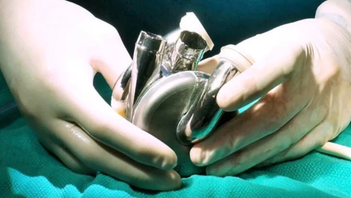 Impressionnant : un homme reçoit un cœur en titane quasiment indestructible 3 1741890097 782 Impressionnant un homme recoit un coeur en titane quasiment.webp