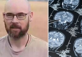 Fraser, un insegnante e ricercatore australiano, ha ricevuto una diagnosi di Alzheimer a 41 anni, ma ha rivelato di aver iniziato ad avere i primi sintomi della malattia almeno due anni prima / Credit YouTube/iStock