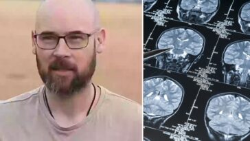 Alzheimer à 41 ans : Fraser raconte comment les premiers symptômes sont apparus deux ans plus tôt 19 Fraser, un insegnante e ricercatore australiano, ha ricevuto una diagnosi di Alzheimer a 41 anni, ma ha rivelato di aver iniziato ad avere i primi sintomi della malattia almeno due anni prima / Credit YouTube/iStock
