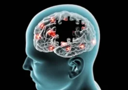 La pollution de l'air favorise-t-elle la maladie d'Alzheimer et d'autres troubles cérébraux ?