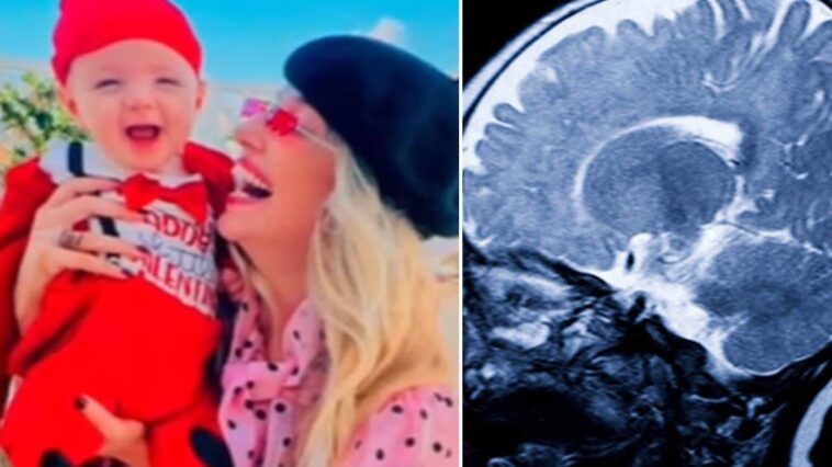 Qu'est-ce que la craniosténose, la déformation du crâne qui a touché le fils de Guenda Goria : symptômes et traitements à connaître 1 Le petit Noah, fils de Guenda Goria et petit-fils de Maria Teresa Ruta, né en juillet 2024, a subi une opération compliquée pour une craniostenose / Photo Verissimo/iStock