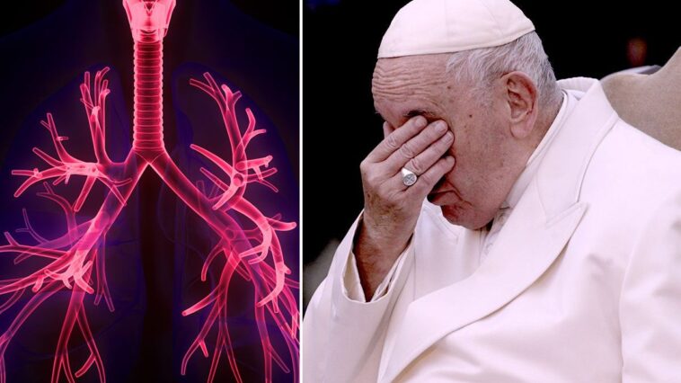 Qu'est-ce que le broncospasme dont a souffert le Pape François, quels en sont les symptômes et comment réagir ? 1 Les dernières nouvelles concernant l'état de santé de Papa François, 88 ans, indiquent l'apparition d'un broncospasme dans l'après-midi du 28 février, une contraction anormale des muscles entourant les bronches / Photo iStock/LaPresse