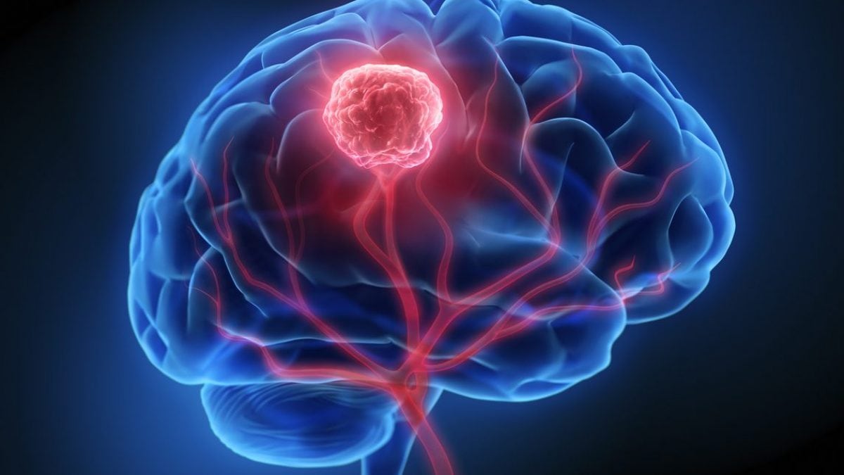Un médicament expérimental double la survie des patients atteints du cancer du cerveau le plus courant et mortel 2 Image