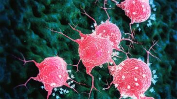 Hausse des cancers du côlon chez les jeunes : des liens suspects avec l'E. coli producteur de colibactine 16 Immagine