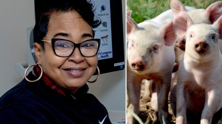 Le rein de porc transplanté à une femme de l'Alabama retiré après plus de quatre mois 1 Towana Looney, 53 anni, ha vissuto per più di 4 mesi con un rene di maiale trapiantato / Credit: NYU Langone Transplant Institute/iStock
