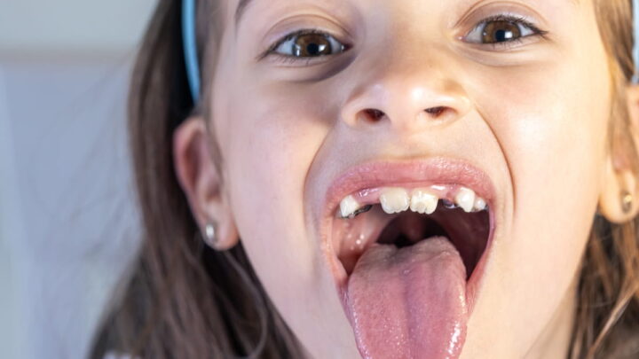 Pour la première fois, des scientifiques réussissent à créer des dents en laboratoire ! 4 1746364944 609 Pour la premiere fois des scientifiques reussissent a creer des