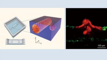 Ainsi naissent les métastases : révélations sur la façon dont les cellules tumorales érodent les vaisseaux et pénètrent dans le sang 6 Il sistema 3D in vivo che mostra il passaggio delle cellule tumorali nel flusso sanguigno. Credit: Università di Tokyo
