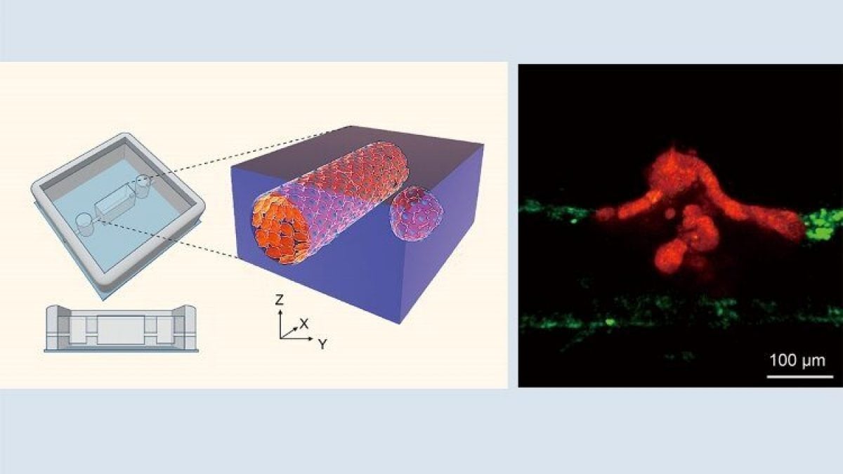Ainsi naissent les métastases : révélations sur la façon dont les cellules tumorales érodent les vaisseaux et pénètrent dans le sang 15 Il sistema 3D in vivo che mostra il passaggio delle cellule tumorali nel flusso sanguigno. Credit: Università di Tokyo