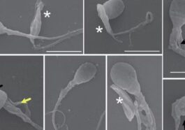 Spermatozoïdes décapités et déformés par le parasite Toxoplasma gondii. Crédit : Rojas-Barón et al/The FEBS Journal, CC BY-SA
