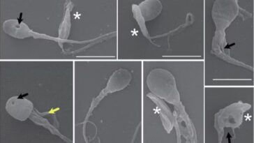 Ce parasite pénètre dans les testicules et décapite les spermatozoïdes : un lien possible avec la chute de la fertilité 19 Spermatozoïdes décapités et déformés par le parasite Toxoplasma gondii. Crédit : Rojas-Barón et al/The FEBS Journal, CC BY-SA